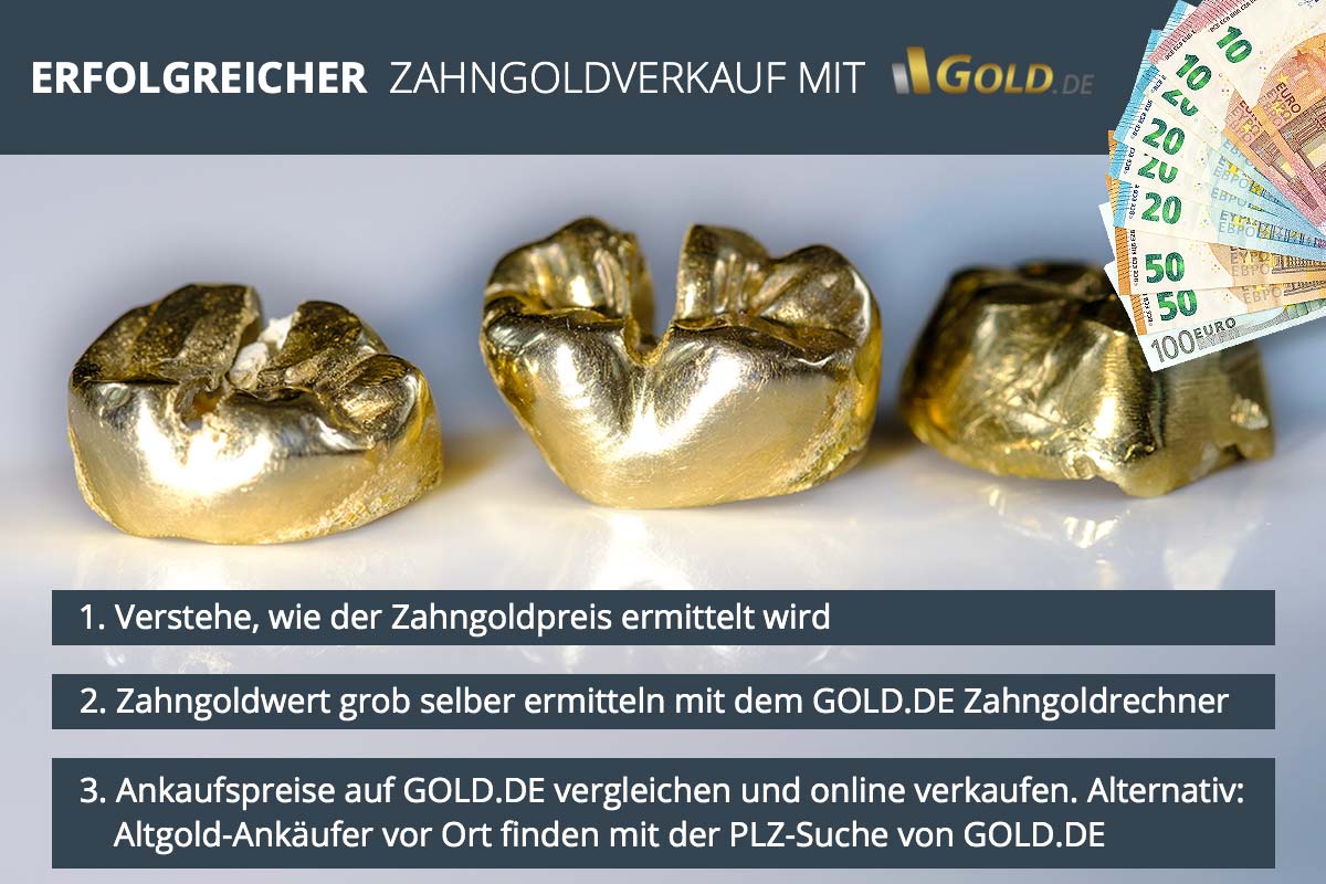 Zahngold verkaufen Preisvergleich